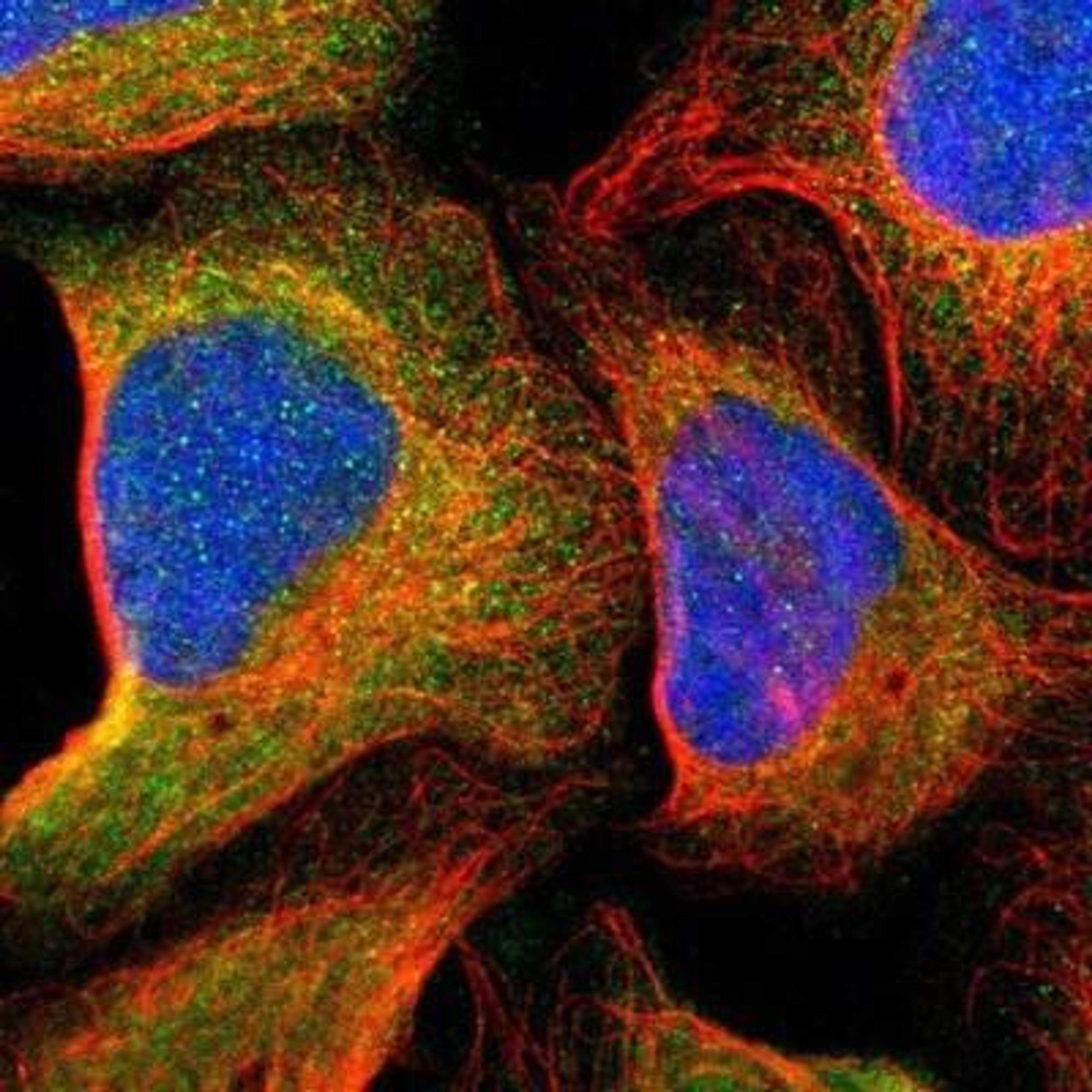 Immunocytochemistry/ Immunofluorescence: ASMTL Antibody [NBP1-86154] - Staining of human cell line U-2 OS shows positivity in cytoplasm.