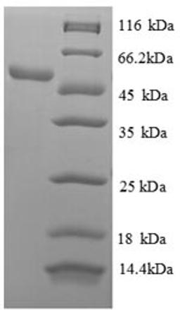 (Tris-Glycine gel) Discontinuous SDS-PAGE (reduced) with 5% enrichment gel and 15% separation gel.