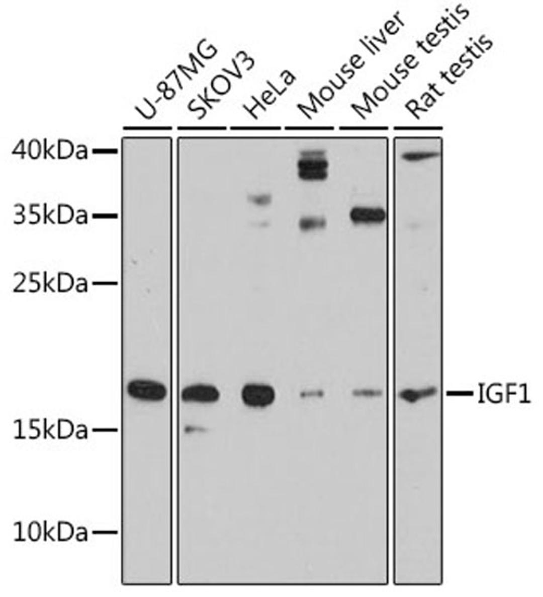 Western blot - IGF1 antibody (A11985)