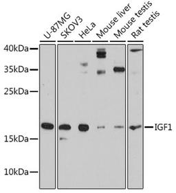 Western blot - IGF1 antibody (A11985)