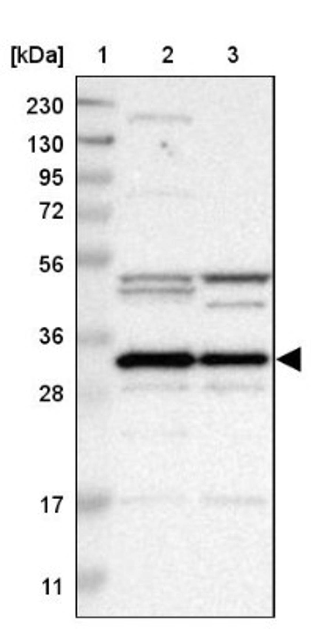 Western Blot: METTL1 Antibody [NBP1-88386] - Lane 1: Marker [kDa] 230, 130, 95, 72, 56, 36, 28, 17, 11<br/>Lane 2: Human cell line RT-4<br/>Lane 3: Human cell line U-251MG sp