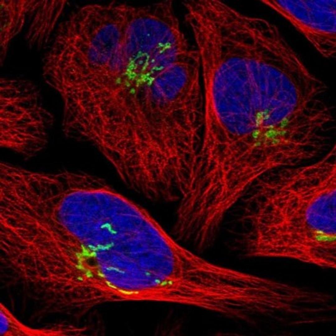 Immunocytochemistry/Immunofluorescence: SLC38A10 Antibody [NBP1-81193] - Staining of human cell line U-2 OS shows positivity in golgi apparatus.