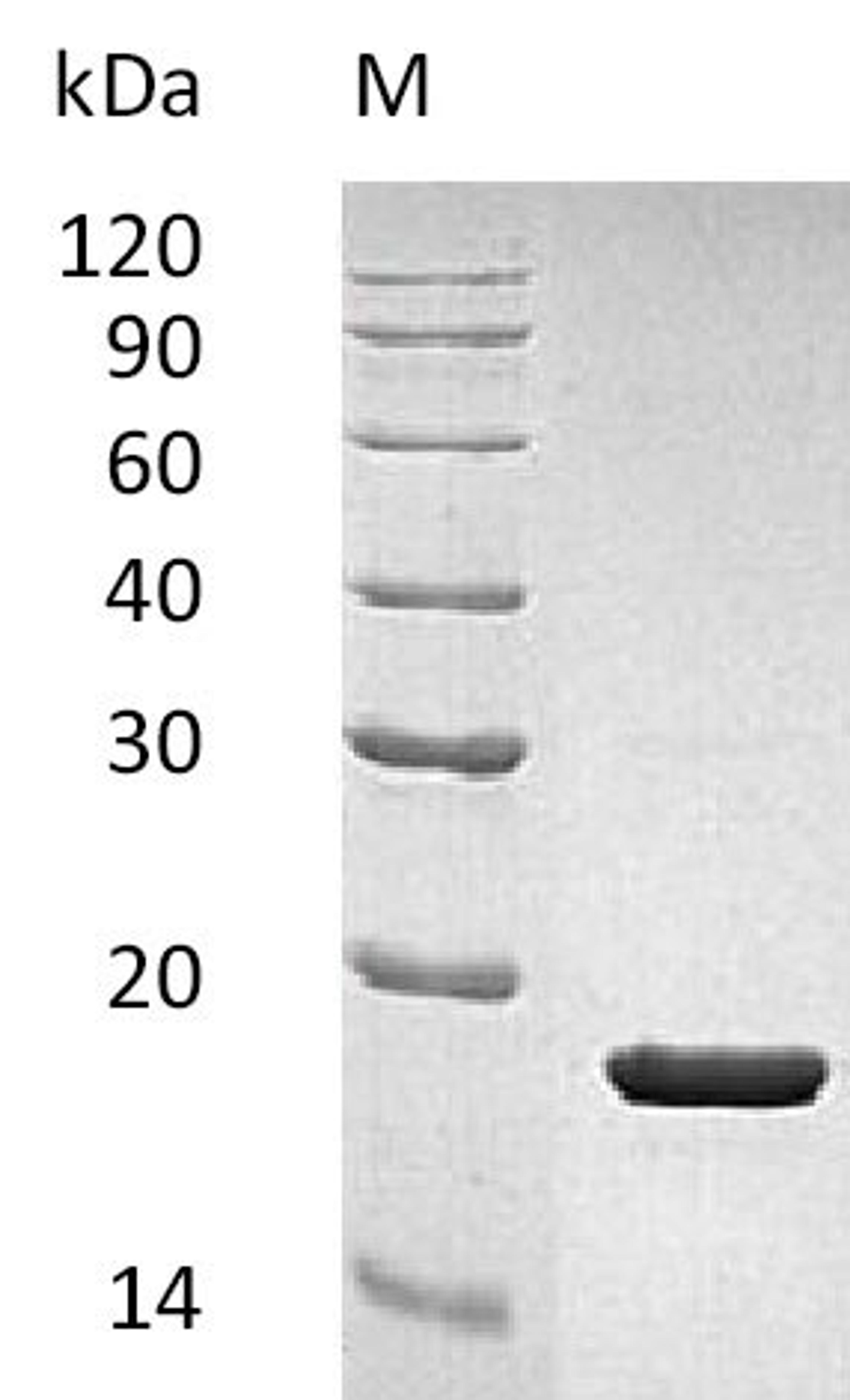 (Tris-Glycine gel) Discontinuous SDS-PAGE (reduced) with 5% enrichment gel and 15% separation gel.