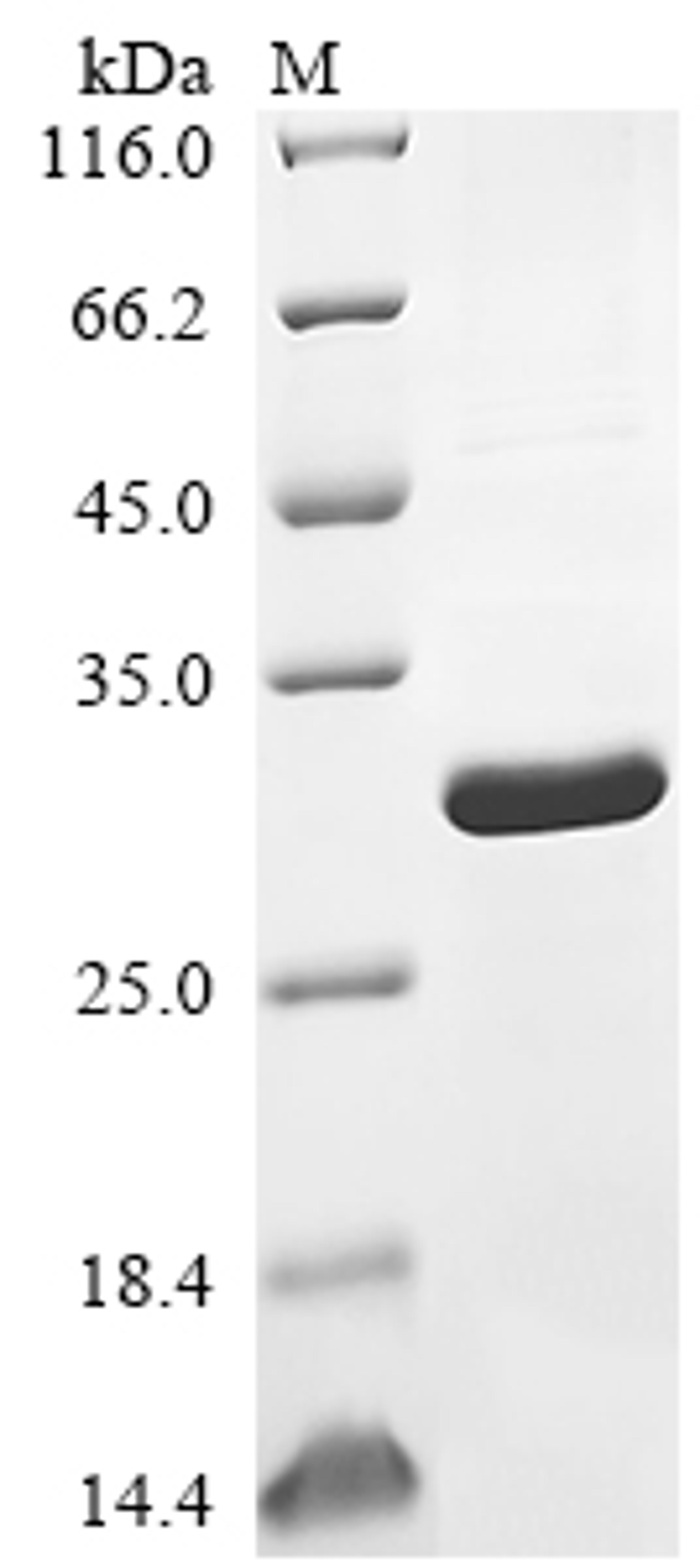 (Tris-Glycine gel) Discontinuous SDS-PAGE (reduced) with 5% enrichment gel and 15% separation gel.