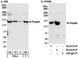 Detection of human Roquin by western blot and immunoprecipitation.