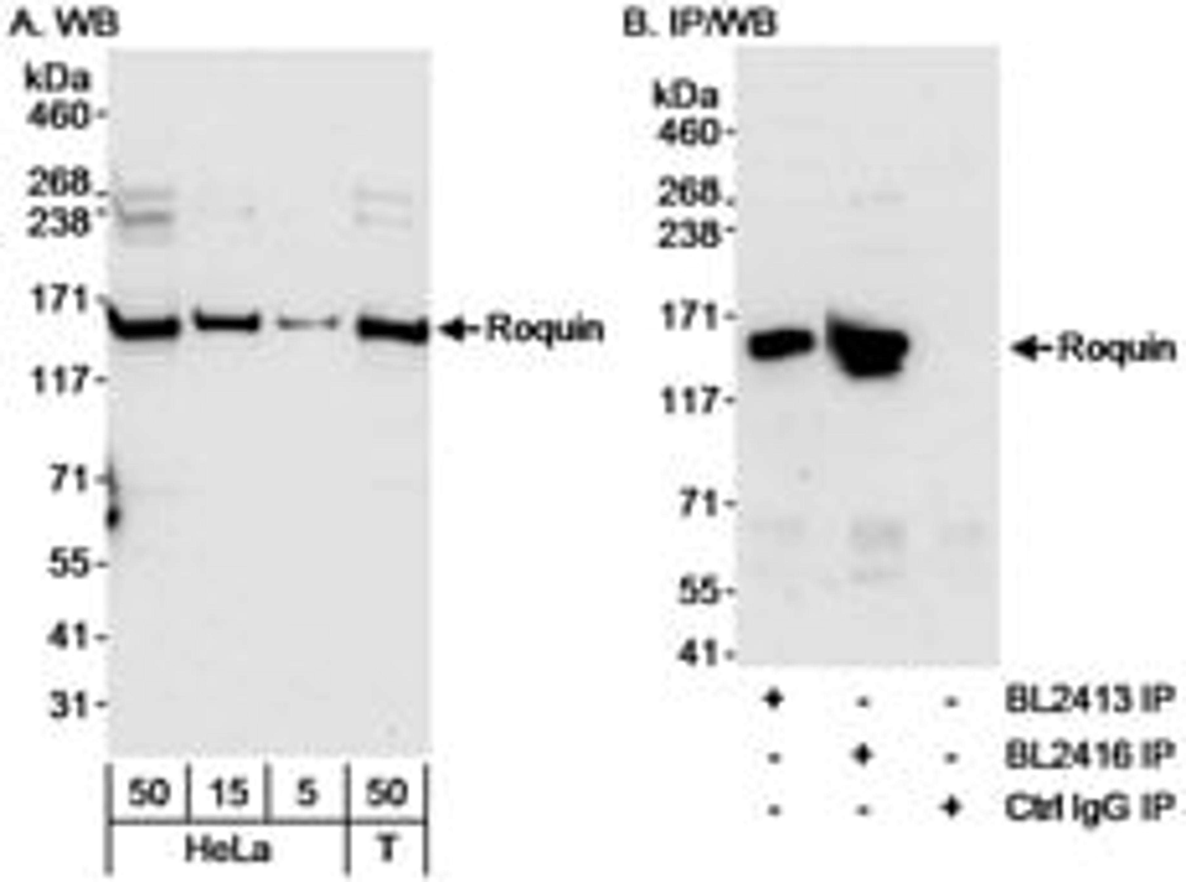 Detection of human Roquin by western blot and immunoprecipitation.