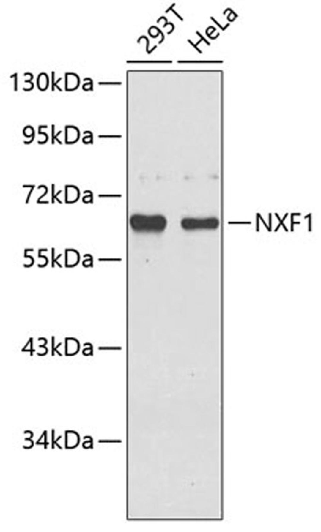 Western blot - NXF1 antibody (A5907)