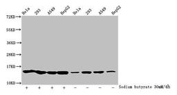 Western Blot. Detected samples: Hela whole cell lysate, 293 whole cell lysate, A549 whole cell lysate, HepG2 whole cell lysate; Untreated (-) or treated (+) with 30mM sodium butyrate for 4h. All lanes: HIST1H2BC antibody at 1:100. Secondary. Goat polyclonal to rabbit IgG at 1/50000 dilution. Predicted band size: 14 kDa. Observed band size: 14 kDa
