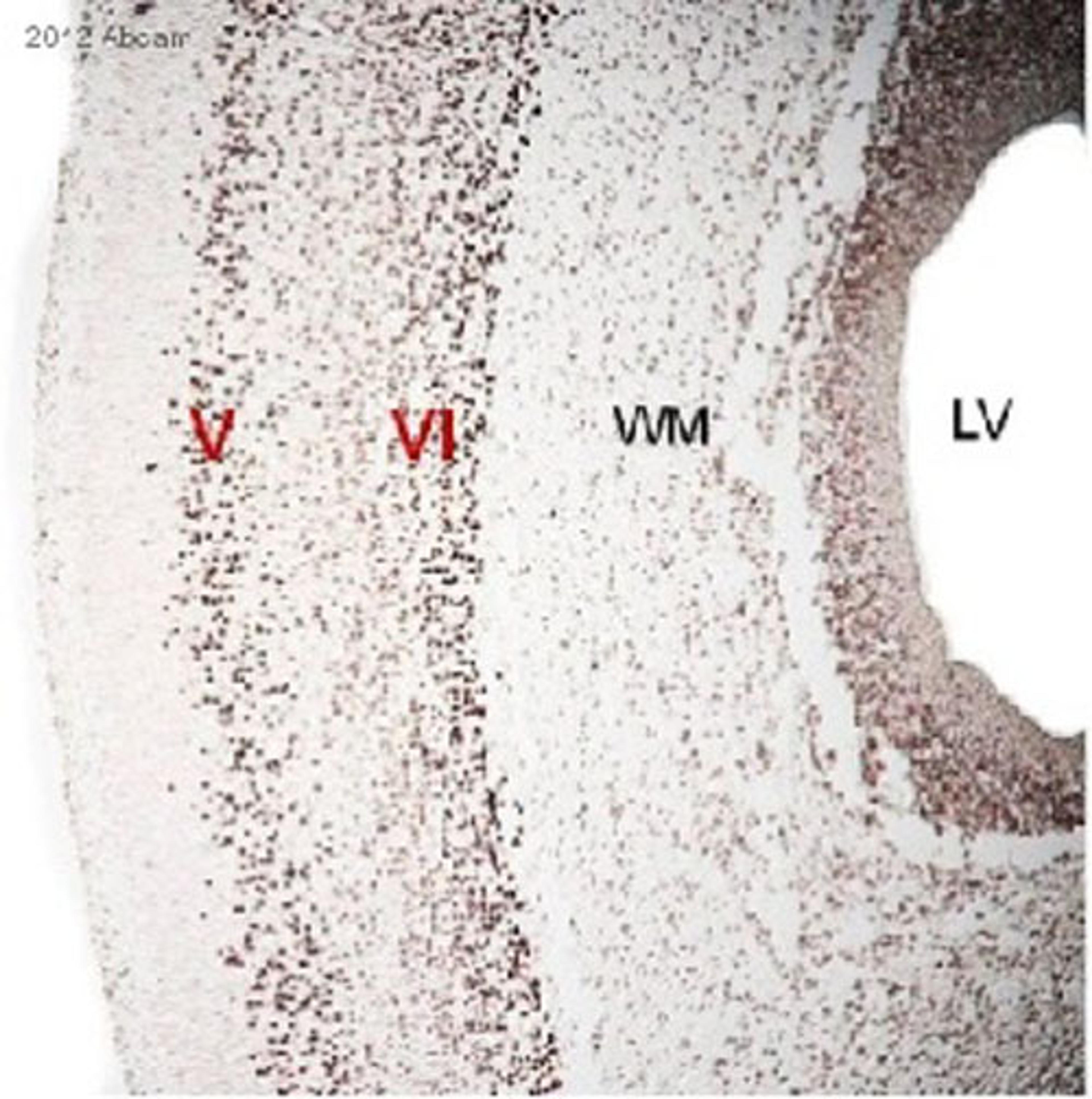 mmunohistochemistry (Formalin/PFA-fixed paraffin-embedded sections)