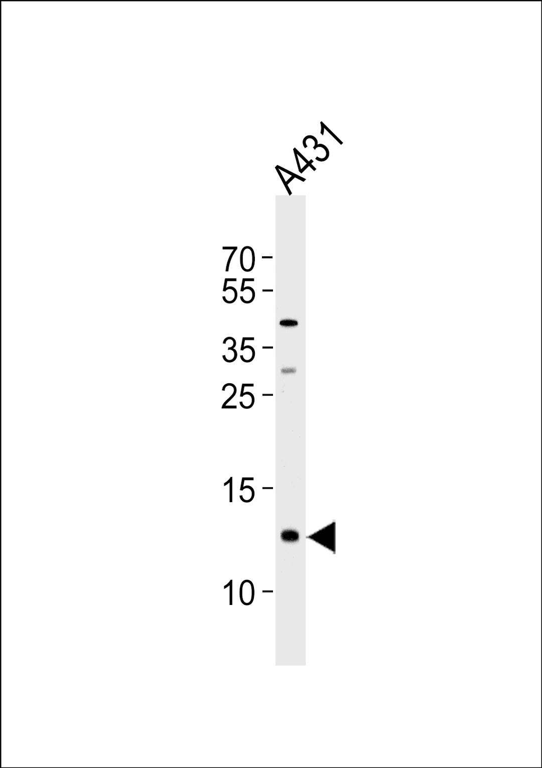 Western blot analysis of lysate from A431 cell line, using SPRR2A Antibody at 1:1000 at each lane.