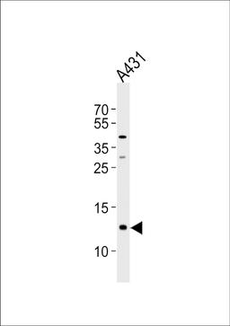 Western blot analysis of lysate from A431 cell line, using SPRR2A Antibody at 1:1000 at each lane.