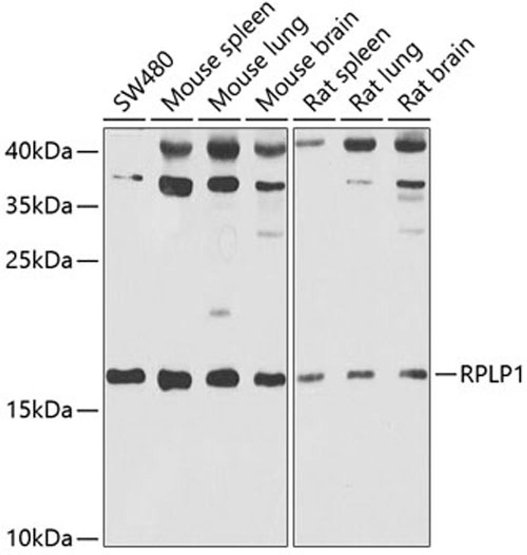 Western blot - RPLP1 antibody (A6725)