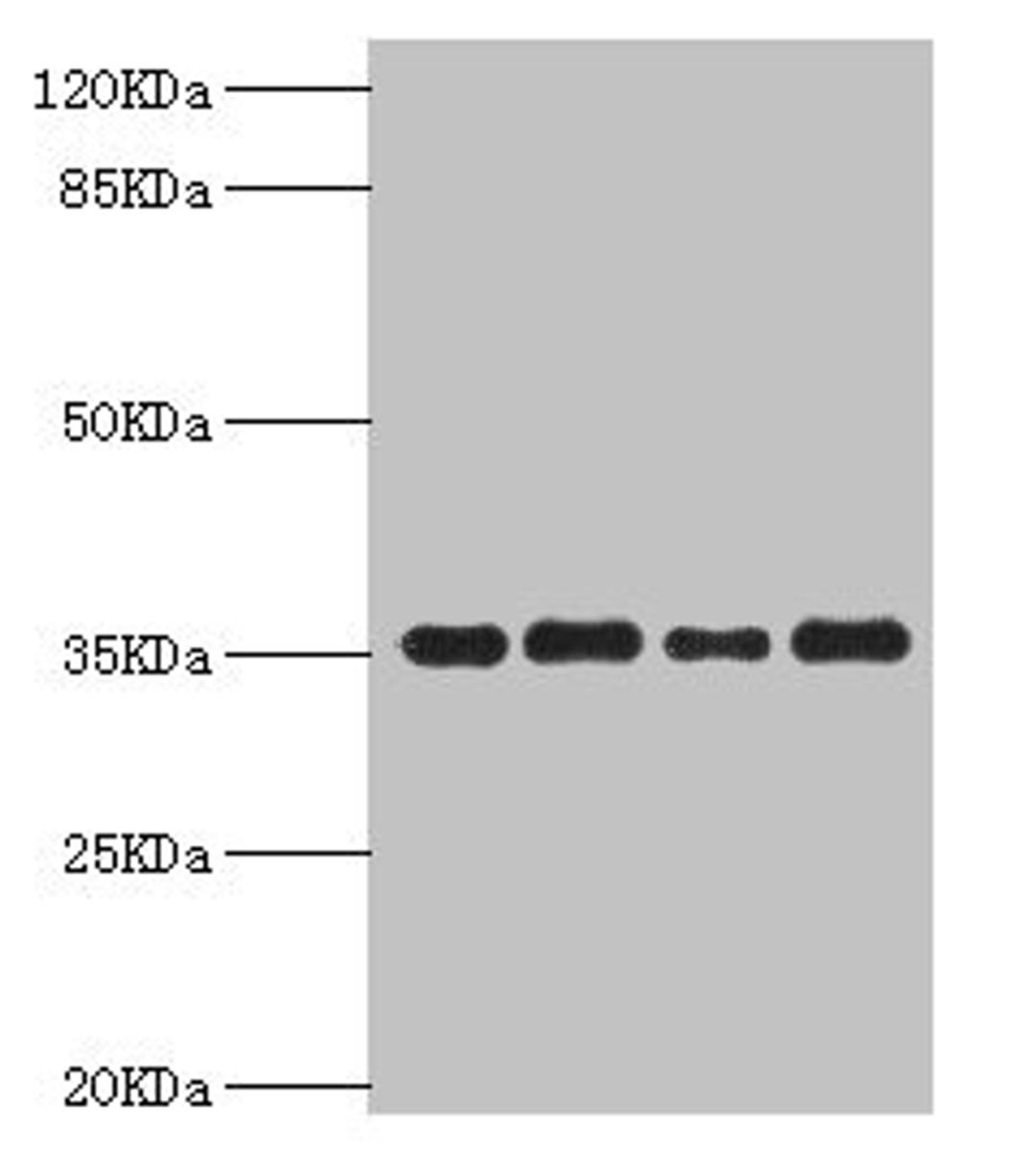 Western blot. All lanes: PDXK antibody at 5.63µg/ml. Lane 1: Mouse liver tissue. Lane 2: Hela whole cell lysate. Lane 3: Mouse kidney tissue. Lane 4: HepG2 whole cell lysate. Secondary. Goat polyclonal to rabbit IgG at 1/10000 dilution. Predicted band size: 36, 32, 27 kDa. Observed band size: 36 kDa