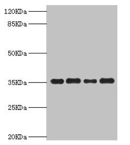 Western blot. All lanes: PDXK antibody at 5.63µg/ml. Lane 1: Mouse liver tissue. Lane 2: Hela whole cell lysate. Lane 3: Mouse kidney tissue. Lane 4: HepG2 whole cell lysate. Secondary. Goat polyclonal to rabbit IgG at 1/10000 dilution. Predicted band size: 36, 32, 27 kDa. Observed band size: 36 kDa