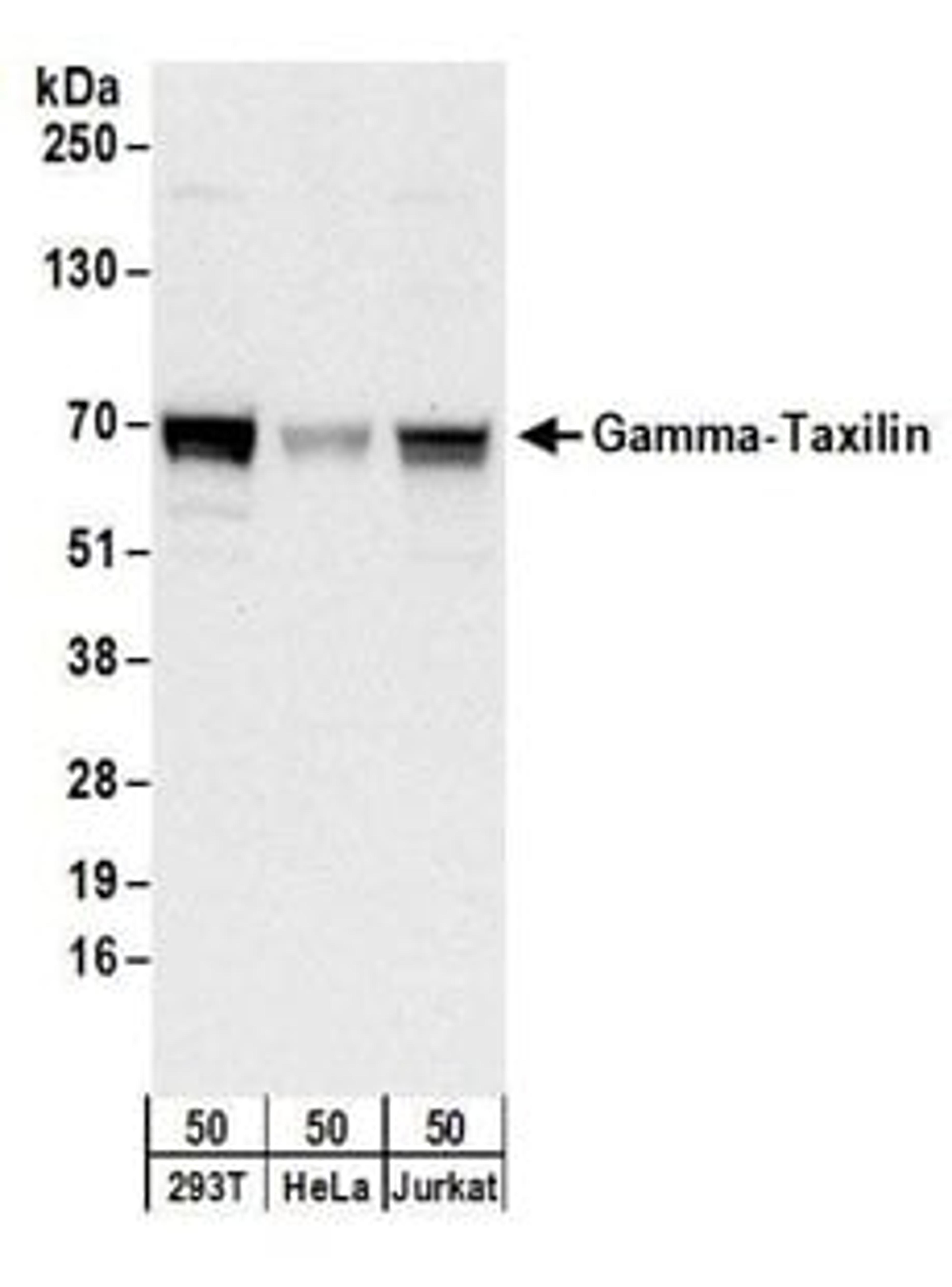 Detection of human Gamma-Taxilin by western blot.