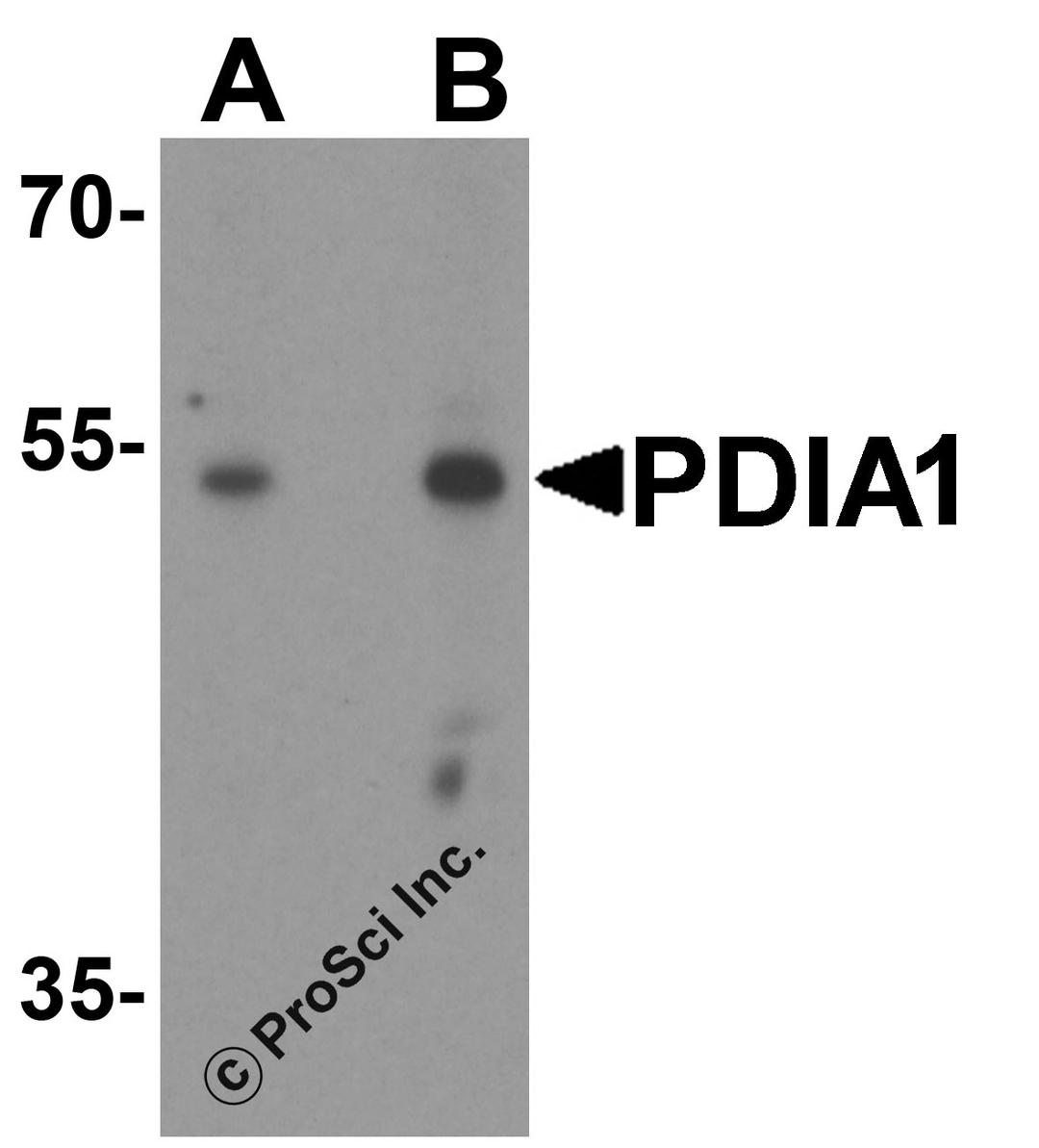 Western blot analysis of PDIA1 in rat small intestine tissue lysate with PDIA1 antibody at (A) 1 and (B) 2 μg/ml.