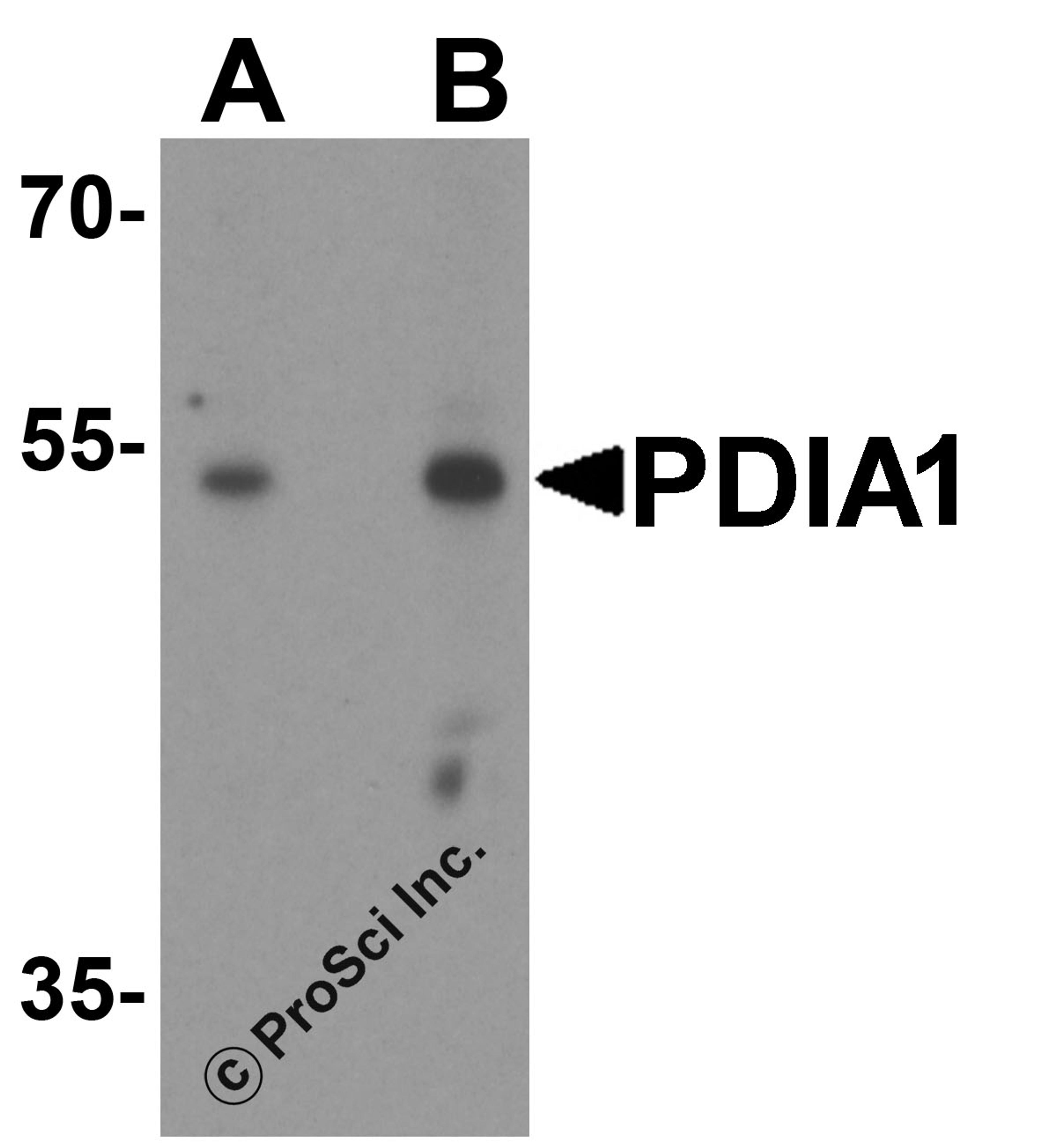 Western blot analysis of PDIA1 in rat small intestine tissue lysate with PDIA1 antibody at (A) 1 and (B) 2 μg/ml.