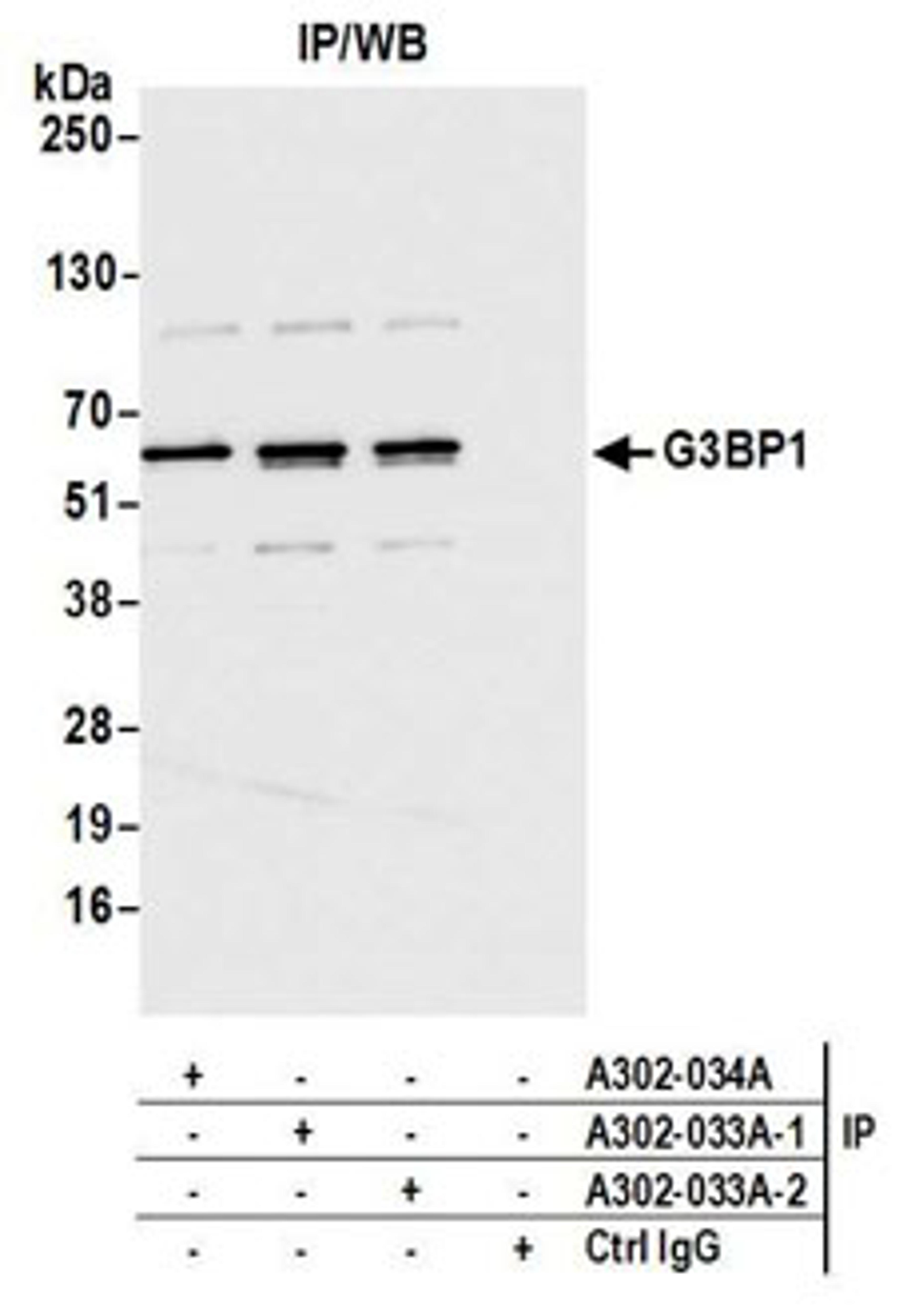 Detection of human G3BP1 by western blot of immunoprecipitates.