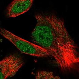 Immunocytochemistry/Immunofluorescence: ABHD1 Antibody [NBP1-91644] - Staining of human cell line U-251 MG shows positivity in nucleus but not nucleoli & cytoplasm.