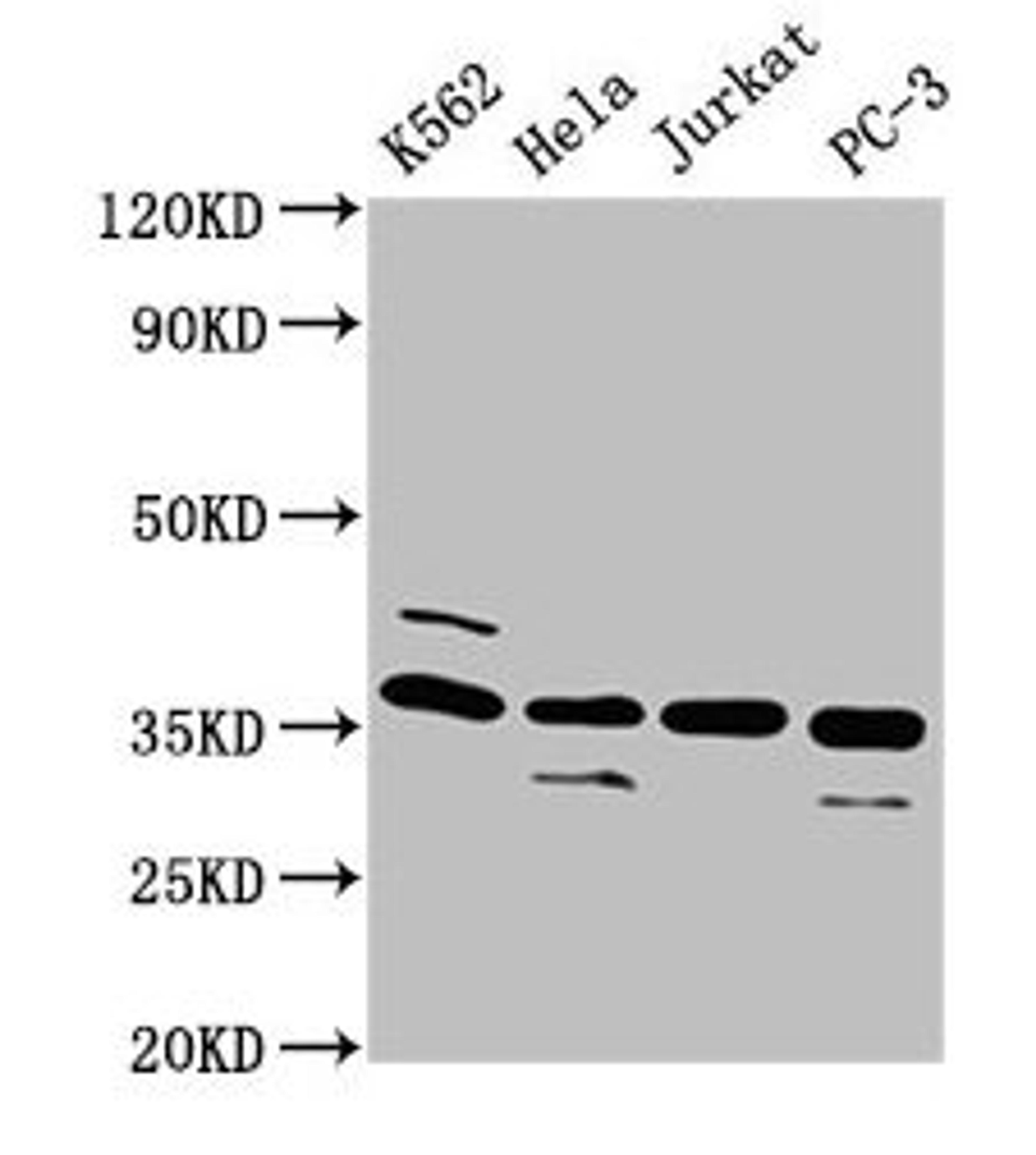 Western Blot. Positive WB detected in: K562 whole cell lysate, Hela whole cell lysate, Jurkat whole cell lysate, PC-3 whole cell lysate. All lanes: ATG3 antibody at 4µg/ml. Secondary. Goat polyclonal to rabbit IgG at 1/50000 dilution. Predicted band size: 36 kDa. Observed band size: 36 kDa