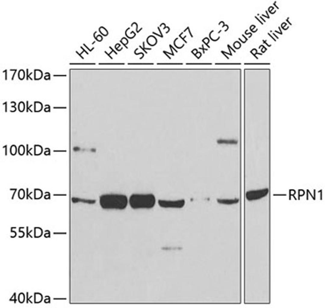 Western blot - RPN1 antibody (A12497)