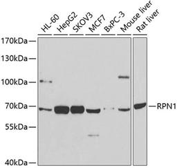 Western blot - RPN1 antibody (A12497)