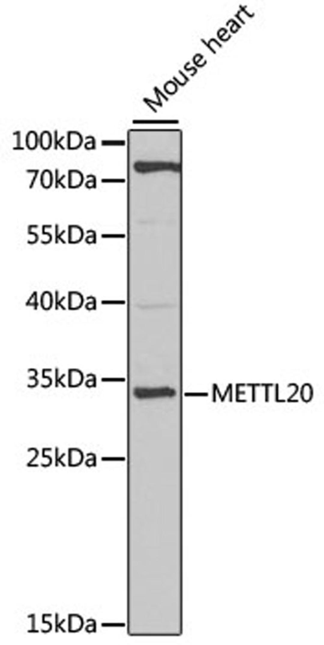 Western blot - METTL20 antibody (A7152)