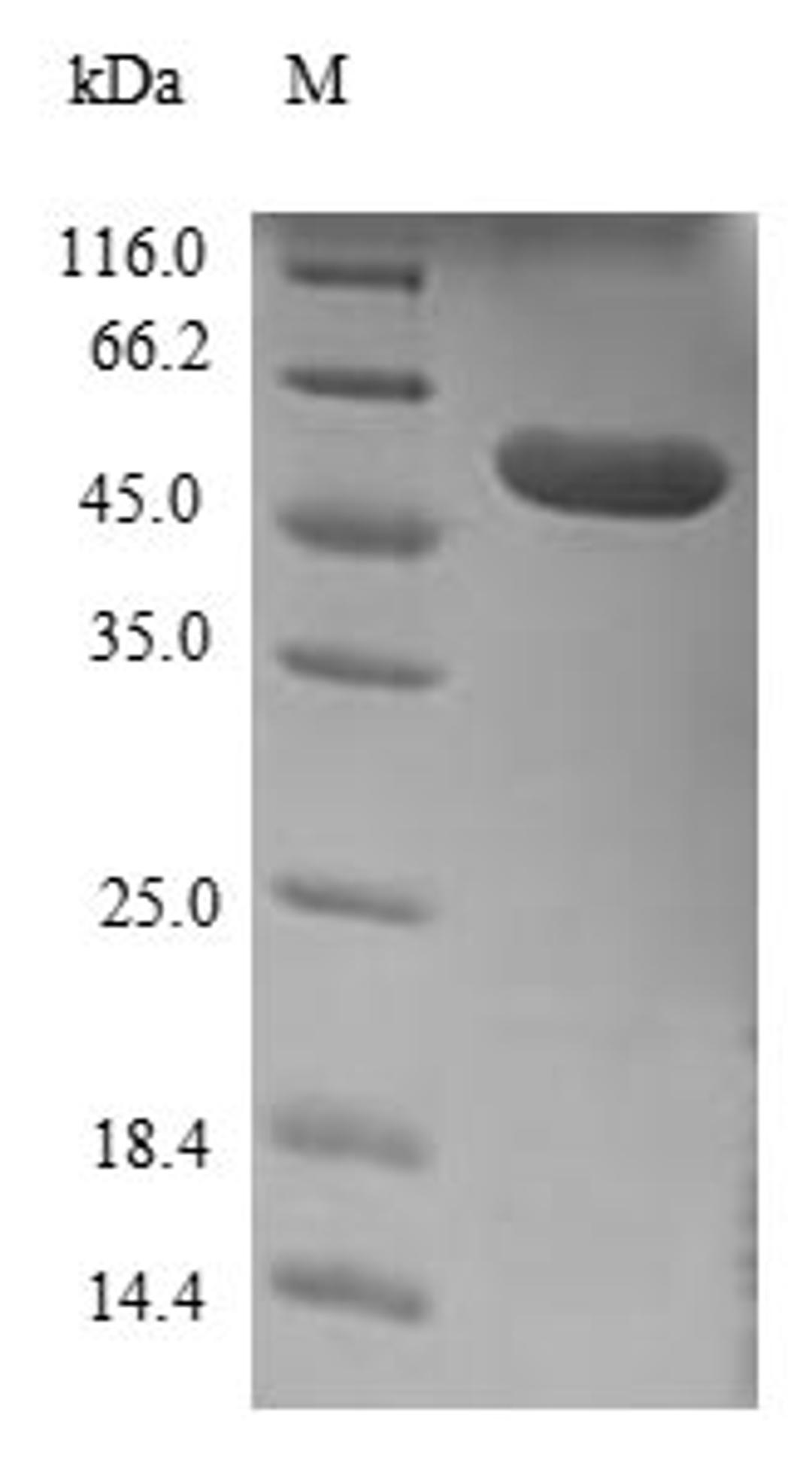 (Tris-Glycine gel) Discontinuous SDS-PAGE (reduced) with 5% enrichment gel and 15% separation gel.