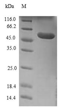 (Tris-Glycine gel) Discontinuous SDS-PAGE (reduced) with 5% enrichment gel and 15% separation gel.