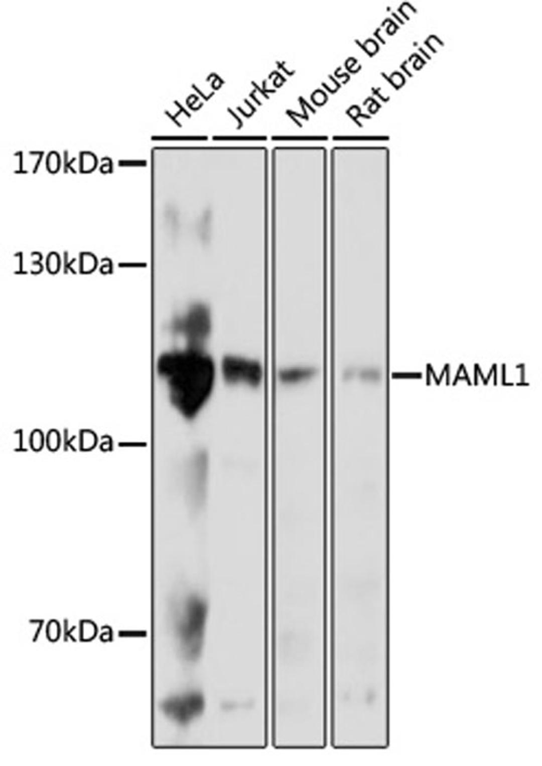 Western blot - MAML1 antibody (A17060)