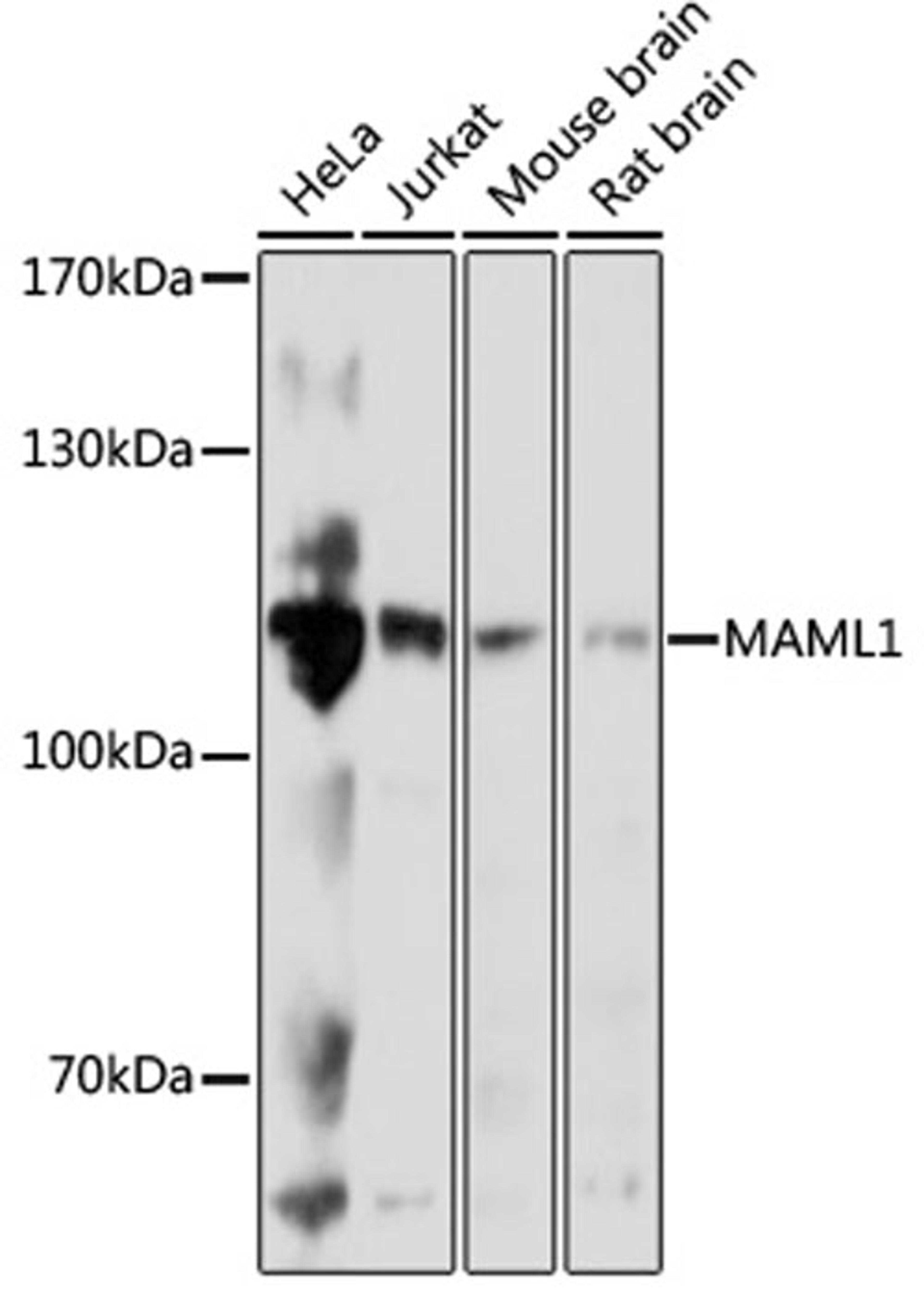 Western blot - MAML1 antibody (A17060)