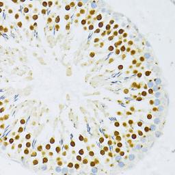 Immunohistochemistry - TFDP1 antibody (A14789)