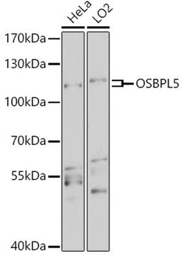 Western blot - OSBPL5 antibody (A18148)