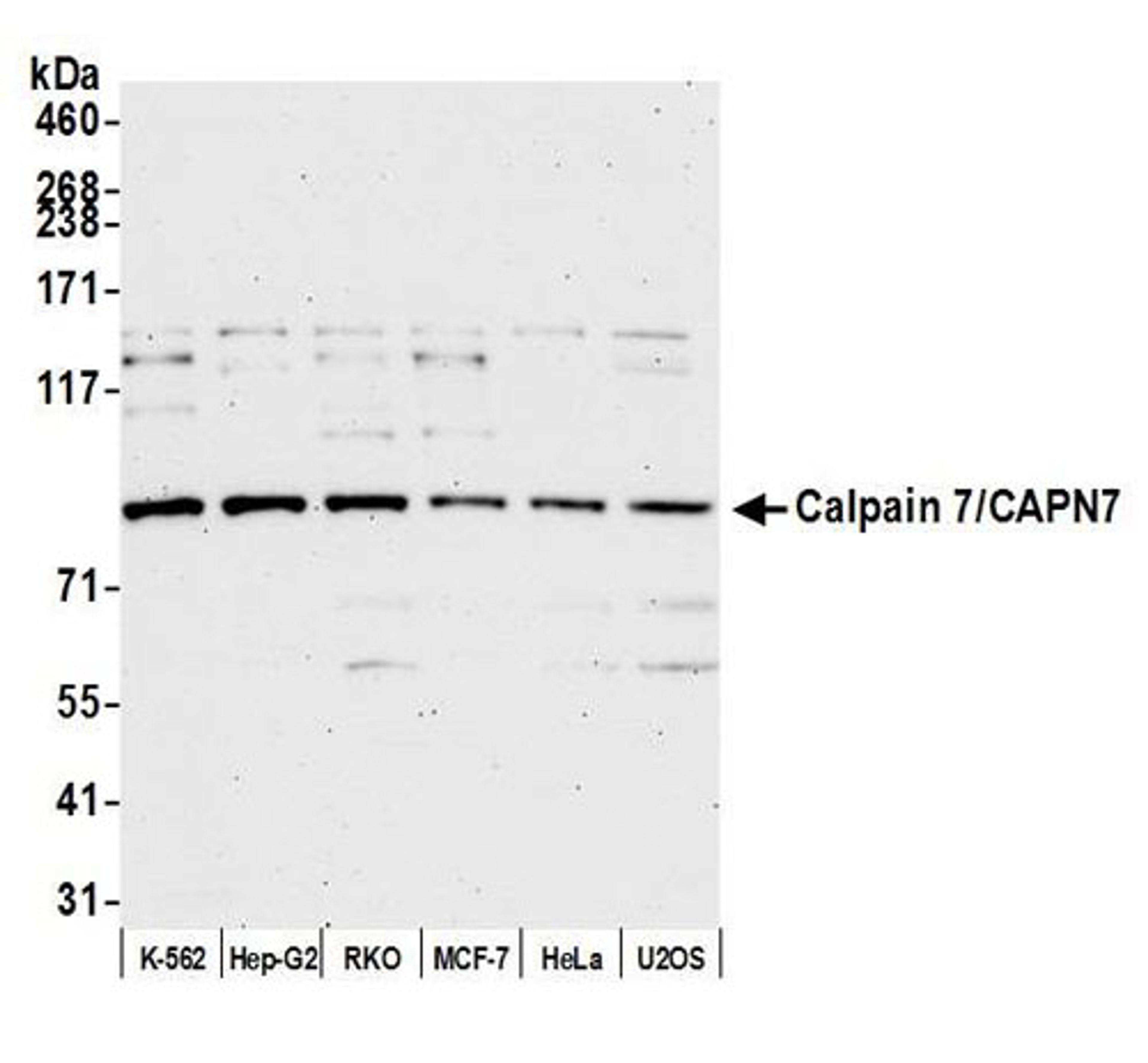 Detection of human Calpain 7/CAPN7 by WB.