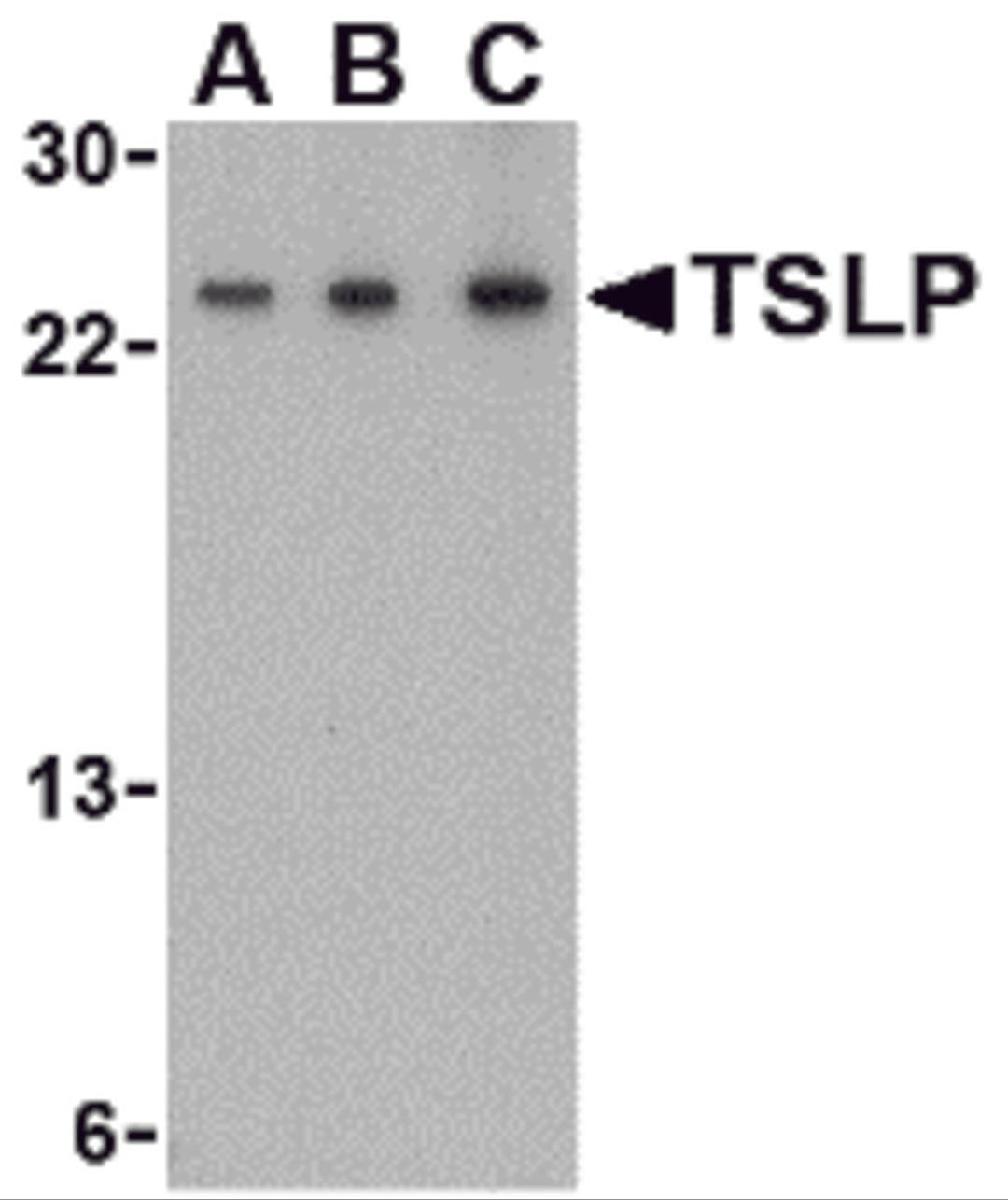 Western blot analysis of TSLP in A-20 cell lysate with TSLP antibody at (A) 0.5, (B) 1 and (C) 2 &#956;g/mL.