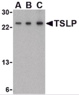 Western blot analysis of TSLP in A-20 cell lysate with TSLP antibody at (A) 0.5, (B) 1 and (C) 2 &#956;g/mL.