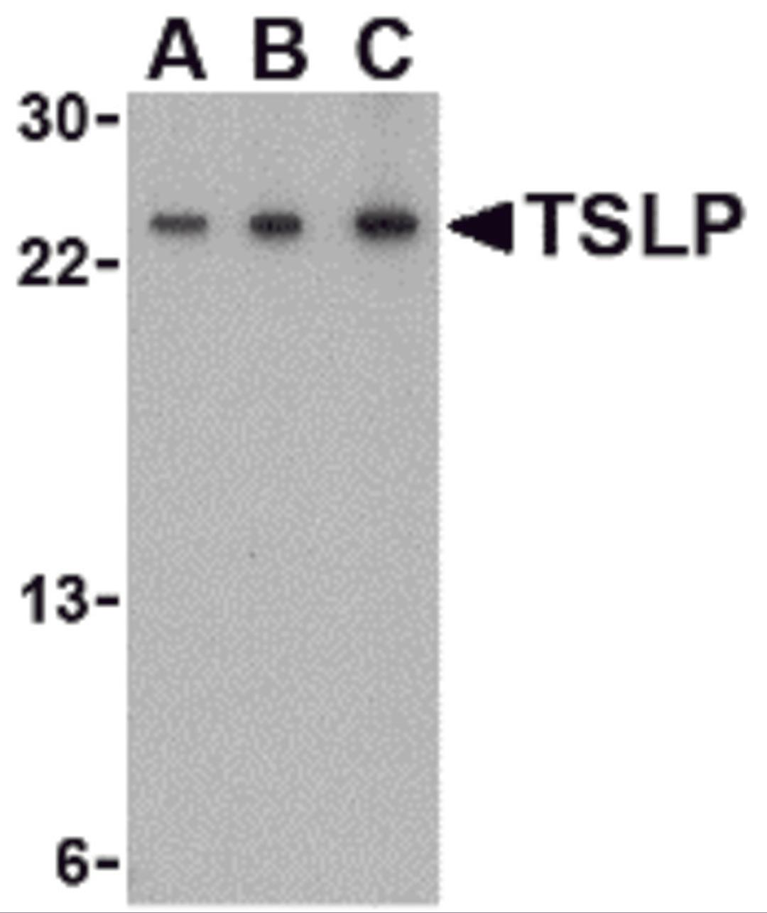 Western blot analysis of TSLP in A-20 cell lysate with TSLP antibody at (A) 0.5, (B) 1 and (C) 2 μg/mL.