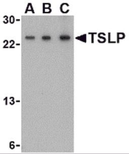 Western blot analysis of TSLP in A-20 cell lysate with TSLP antibody at (A) 0.5, (B) 1 and (C) 2 μg/mL.