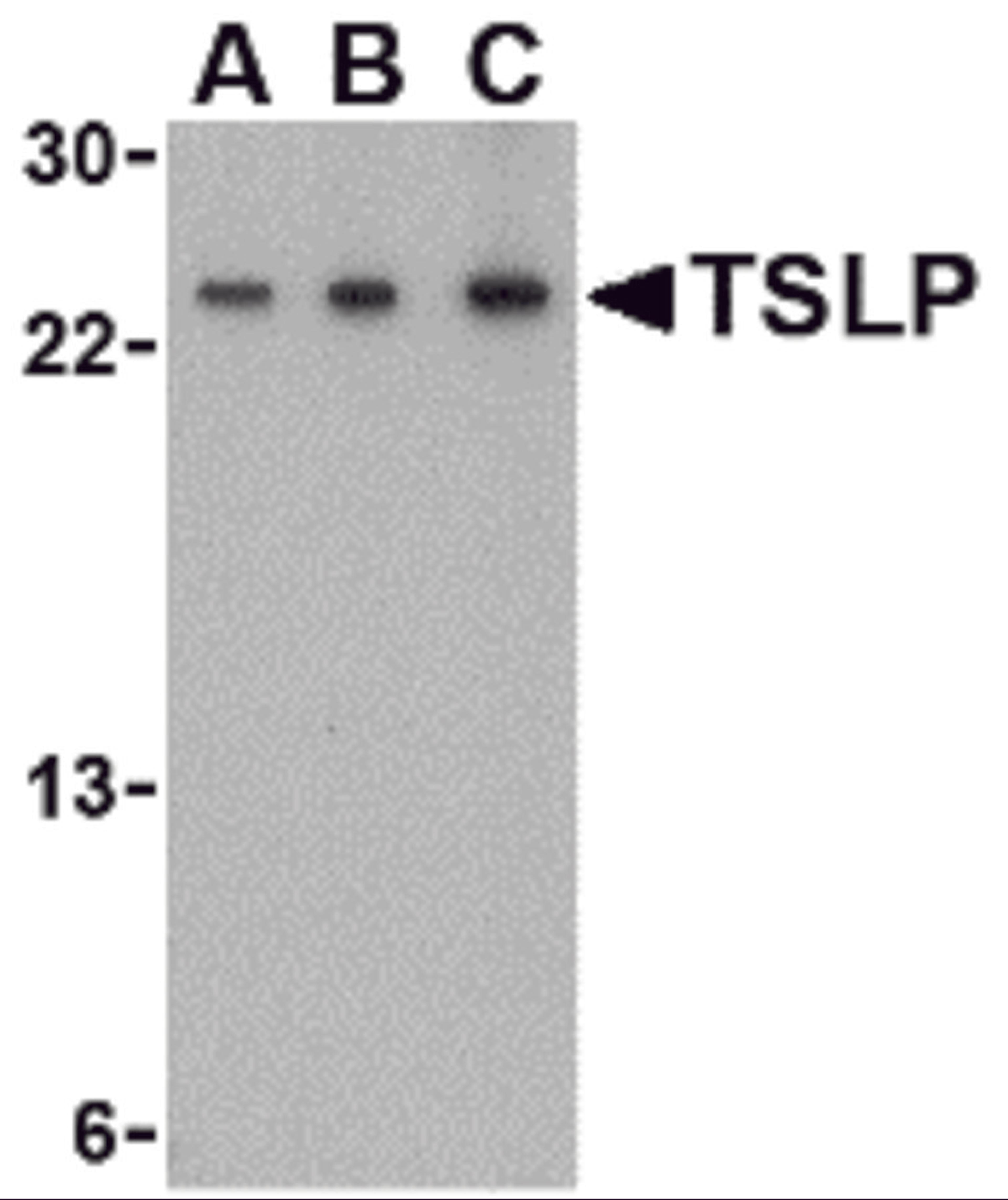 Western blot analysis of TSLP in A-20 cell lysate with TSLP antibody at (A) 0.5, (B) 1 and (C) 2 μg/mL.