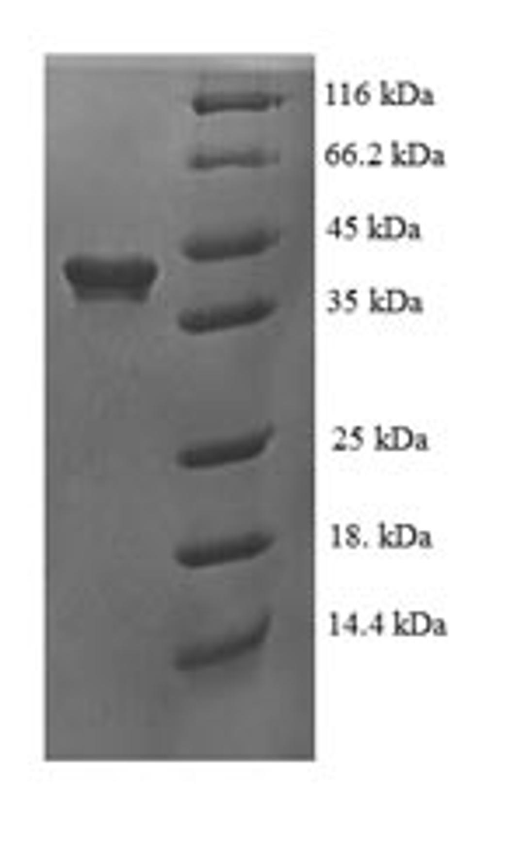 (Tris-Glycine gel) Discontinuous SDS-PAGE (reduced) with 5% enrichment gel and 15% separation gel.