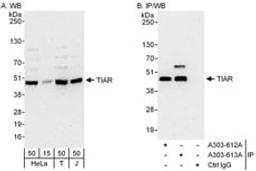 Detection of human TIAR by western blot and immunoprecipitation.