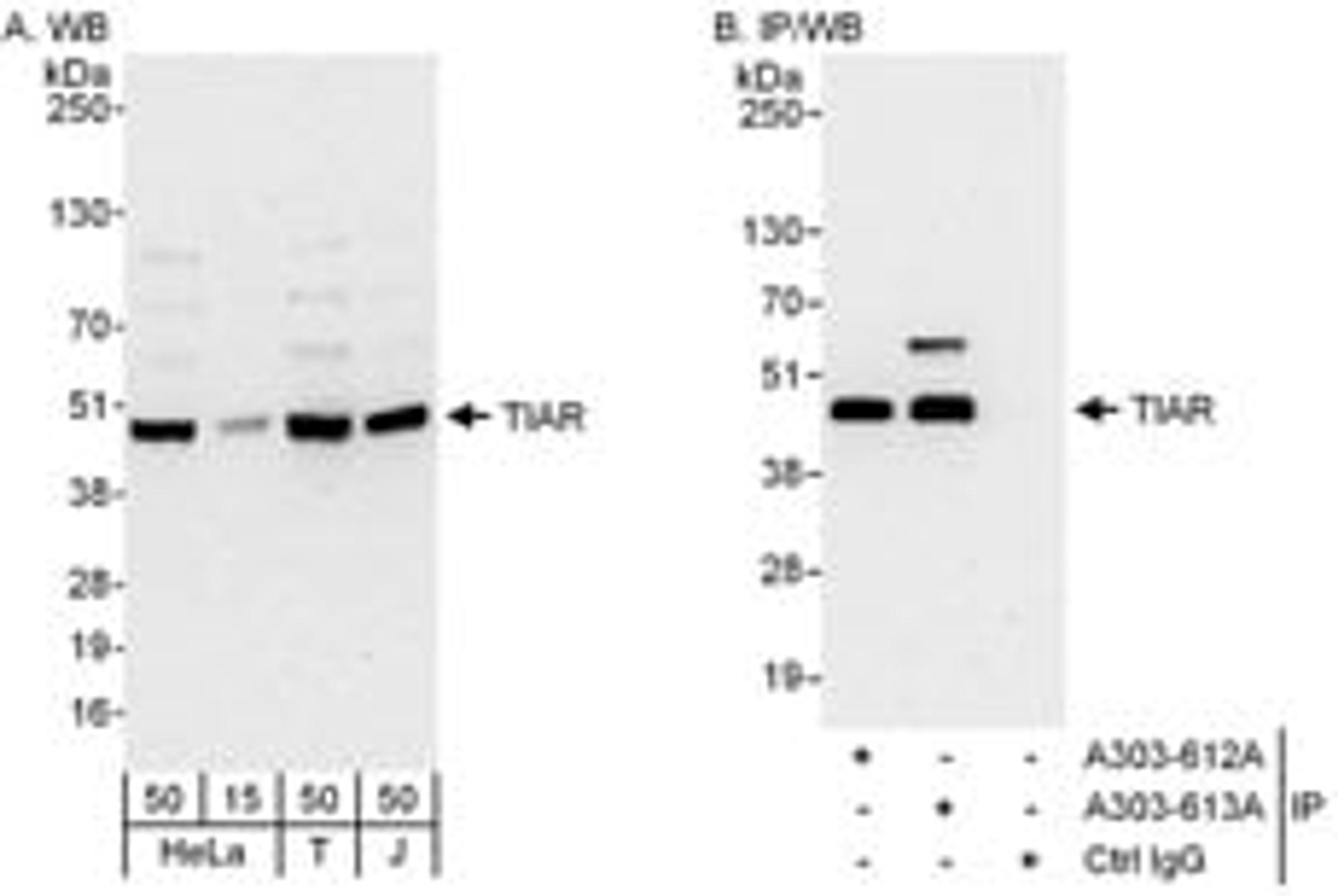 Detection of human TIAR by western blot and immunoprecipitation.