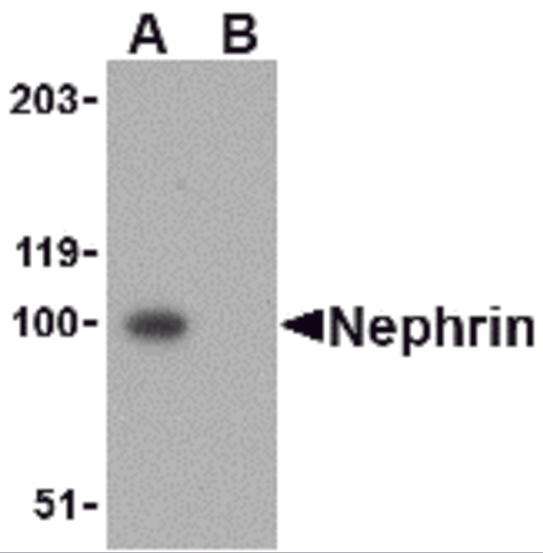 Western blot analysis of Nephrin in mouse kidney tissue lysate with Nephrin antibody at 1 &#956;g/mL in the (A) absence and (B) presence of blocking peptide.