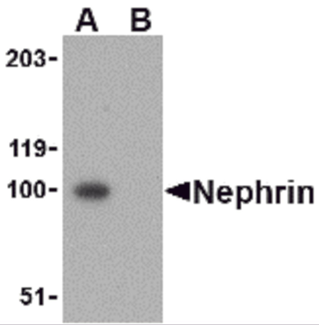 Western blot analysis of Nephrin in mouse kidney tissue lysate with Nephrin antibody at 1 μg/mL in the (A) absence and (B) presence of blocking peptide.