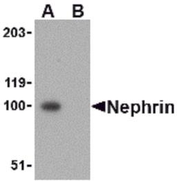 Western blot analysis of Nephrin in mouse kidney tissue lysate with Nephrin antibody at 1 μg/mL in the (A) absence and (B) presence of blocking peptide.