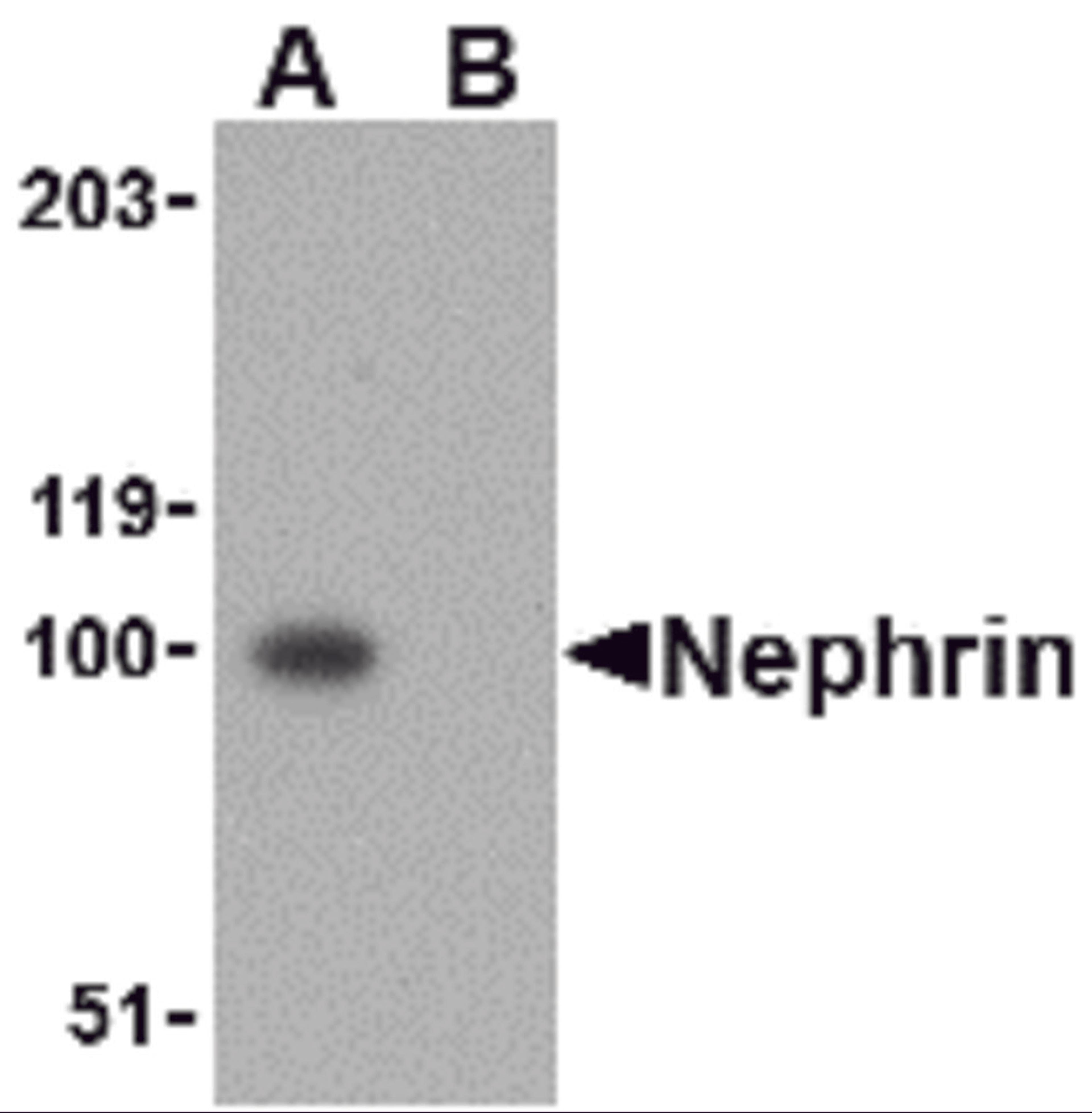 Western blot analysis of Nephrin in mouse kidney tissue lysate with Nephrin antibody at 1 μg/mL in the (A) absence and (B) presence of blocking peptide.