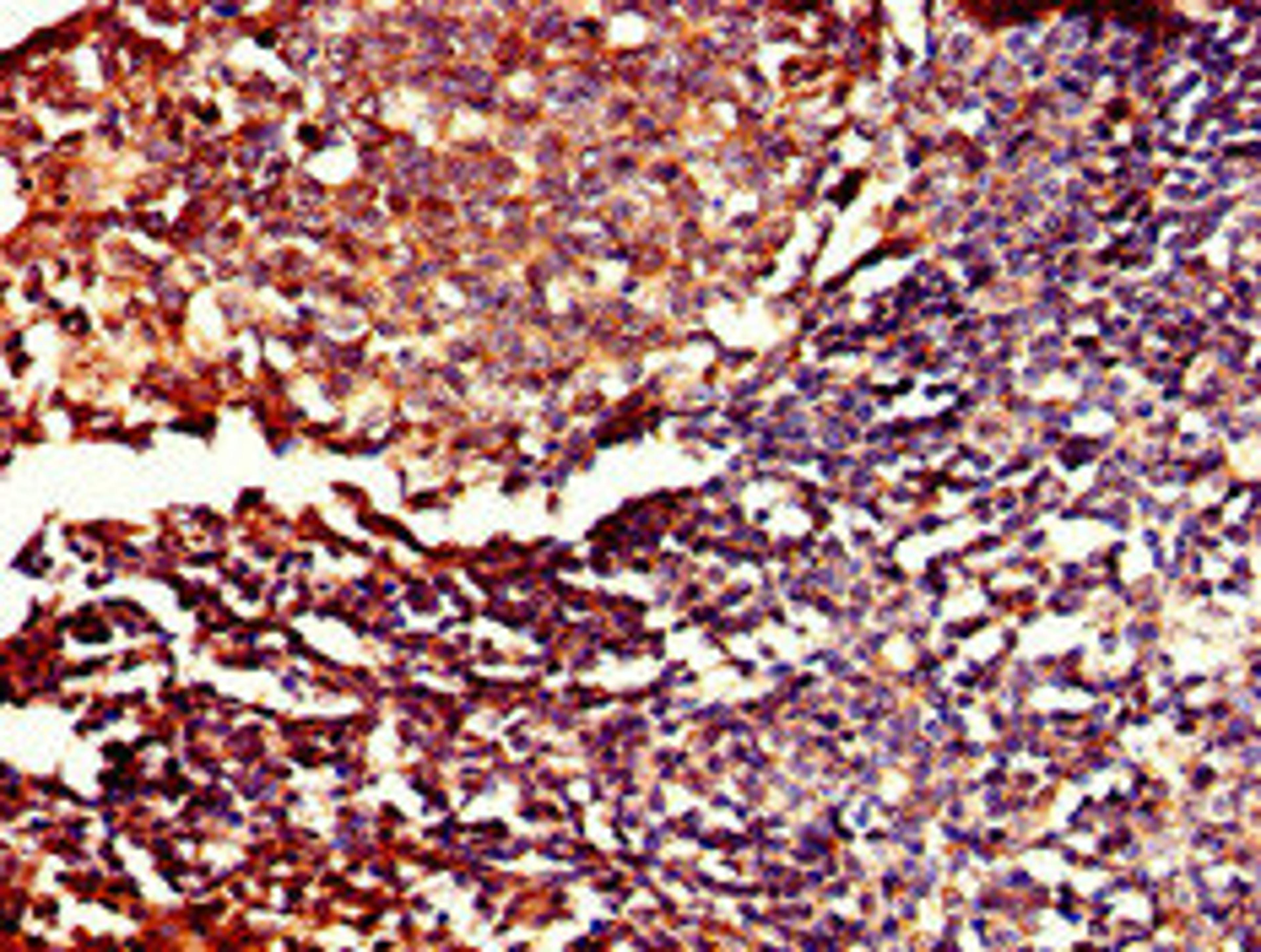 Immunohistochemistry of paraffin-embedded human tonsil tissue using CSB-PA875726LA01HU at dilution of 1:100