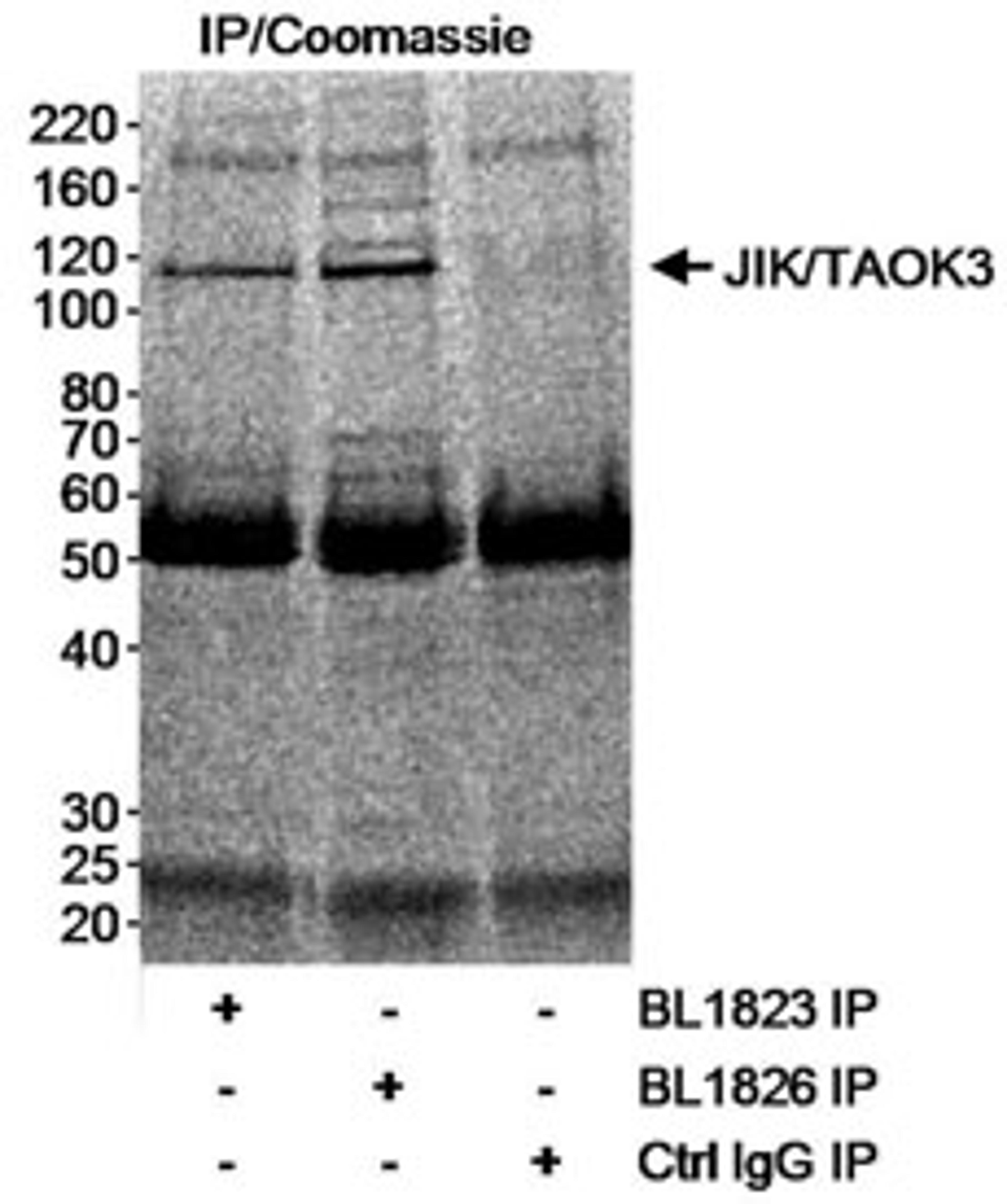 Detection of human JIK/TAOK3 by immunoprecipitation.