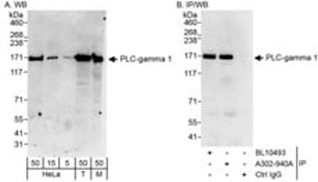 Detection of human and mouse PLC-gamma 1 by western blot (h&m) and immunoprecipitation (h).