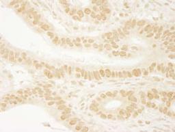 Detection of human Leo1 by immunohistochemistry.